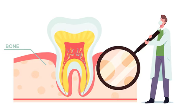 Rotary Endodontics and Apex Locators